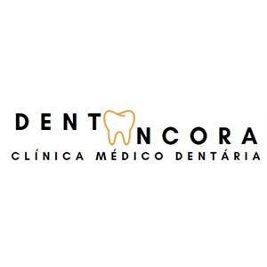 Dentoâncora
